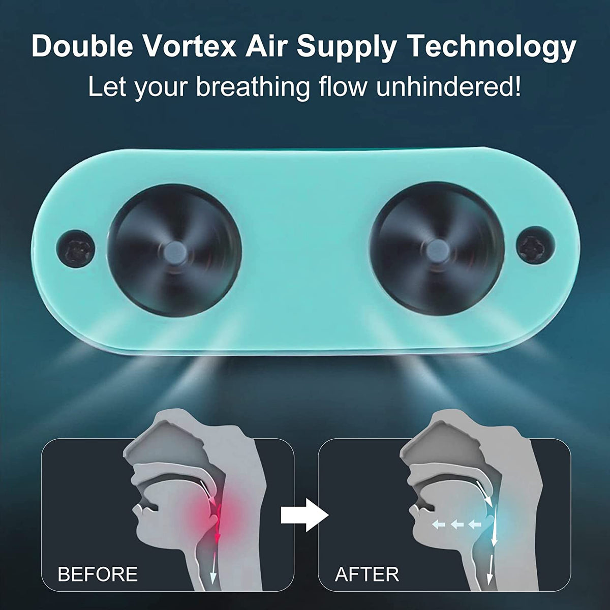 Cfowner Electric Anti Snoring Devices, Obvious Effect, Safe & Comfortable, Double Eddy Current, for Men Women All Nose Shapes and All Ages to Reduce Snoring